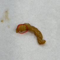 啊？ 肉裏面這個是什麼？