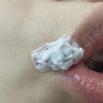 好無言   怎麼就長皰疹了